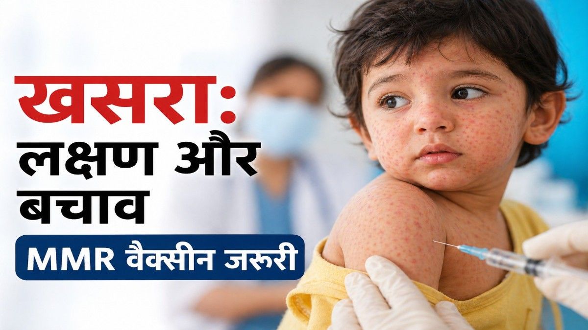 चेन्नई में खसरे की दस्तक: एक खुराक चूकी तो बढ़ सकता है खतरा, WHO की रिपोर्ट भी दे रही चेतावनी